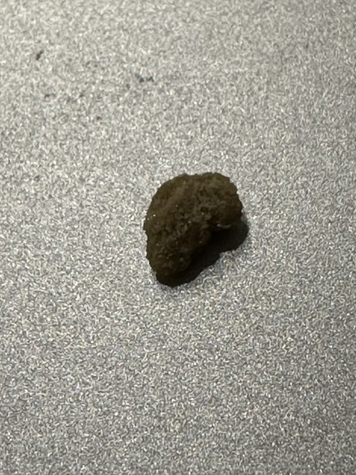 刚尿出一个石头-有5mm-惠小助(52huixz.com)