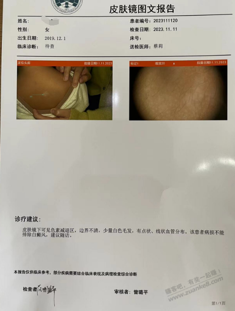 吧医请进，三岁女孩长这个白斑，有没有了解的 - 线报迷