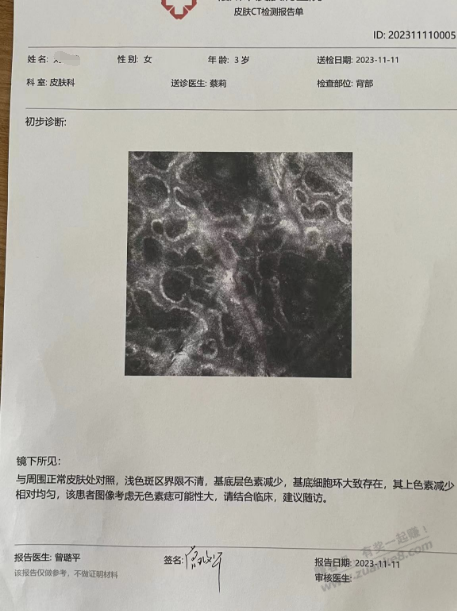 吧医请进，三岁女孩长这个白斑，有没有了解的 - 线报迷