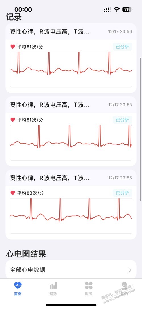 心脏突然就b型应激综合征？ - 线报迷