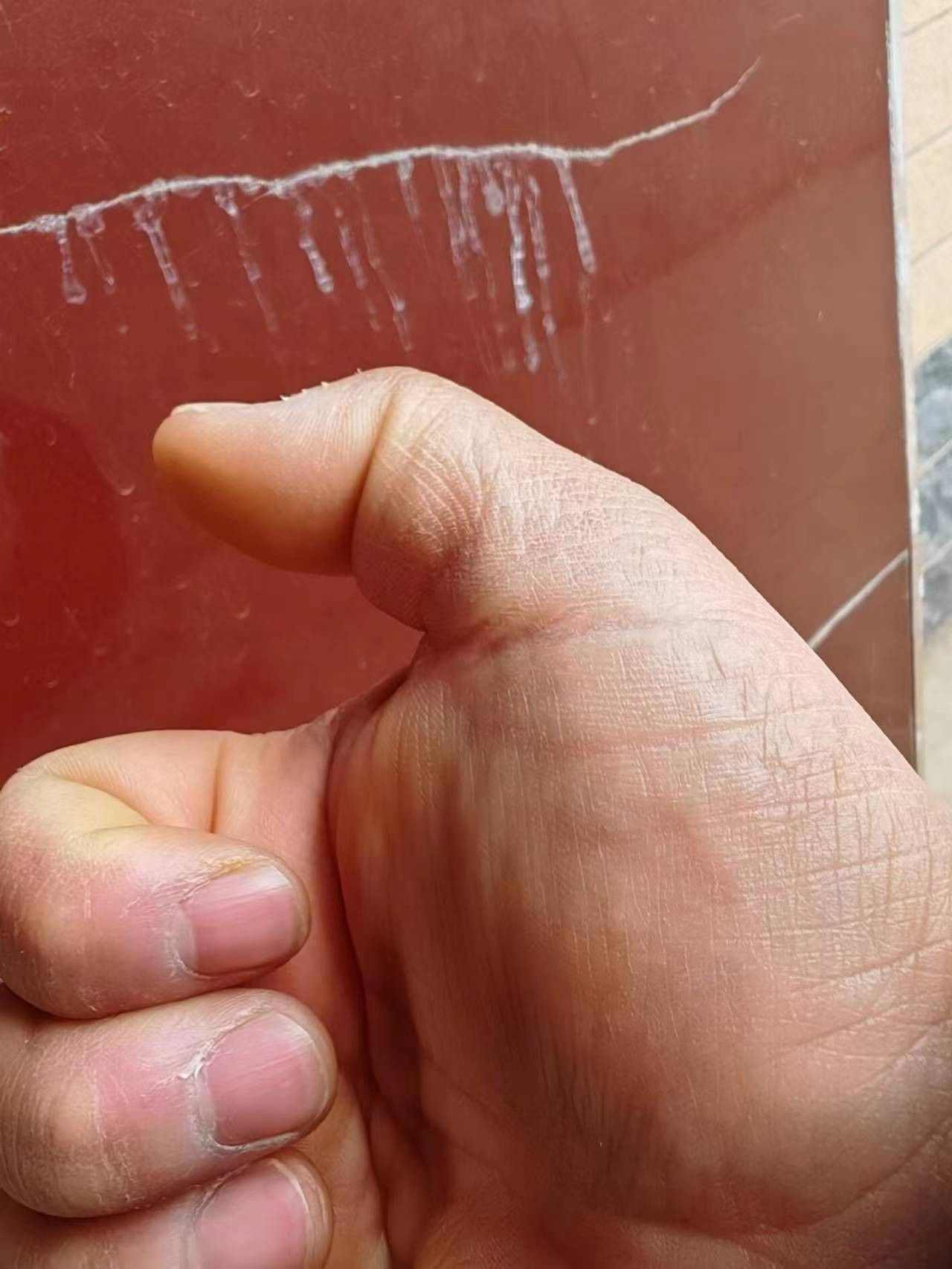 有吧医吗？看看手掌这是什么，谢谢 - 线报迷