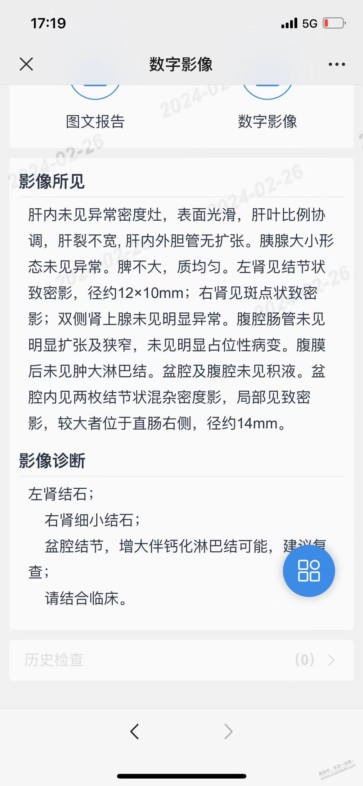 盆腔结节，增大伴钙化淋巴结可能 有吧友了解吗 - 线报迷