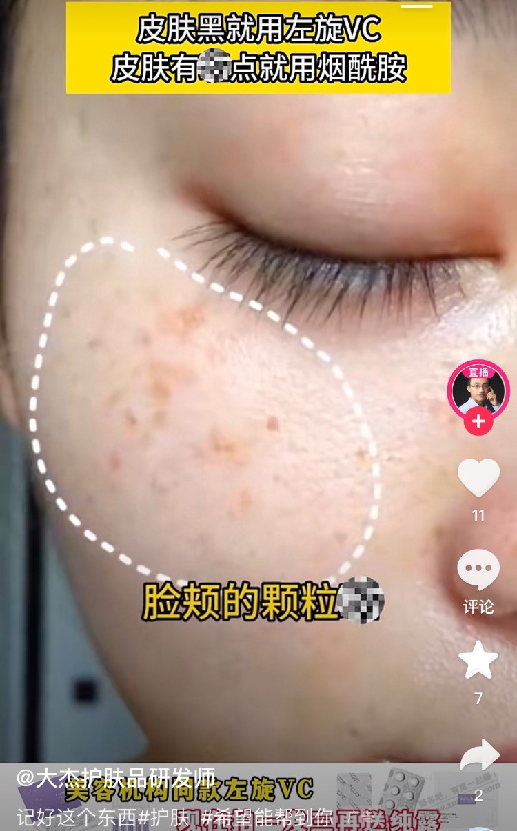 这种祛斑有用吗 - 线报迷