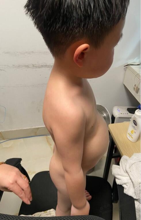 5岁不到的小孩肚子好大,有没有同款的，求经验 - 线报迷