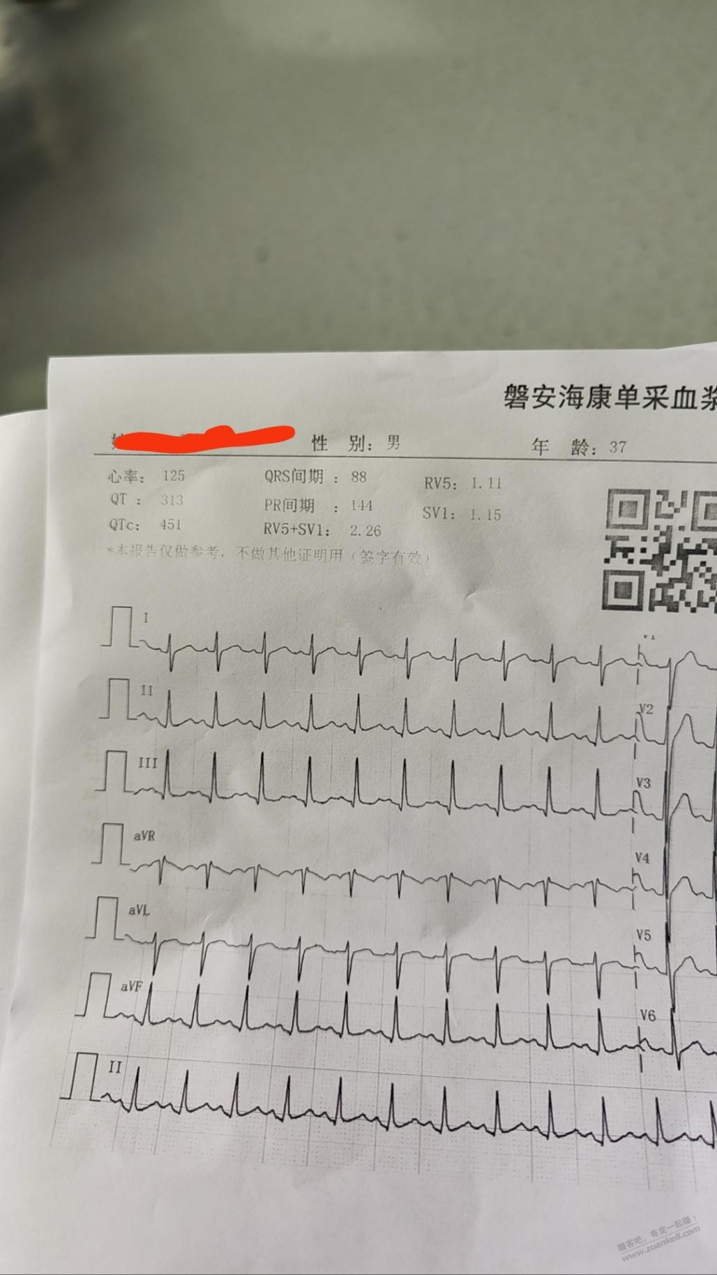 38岁就心跳100多了咋办还有救吗 - 线报酷