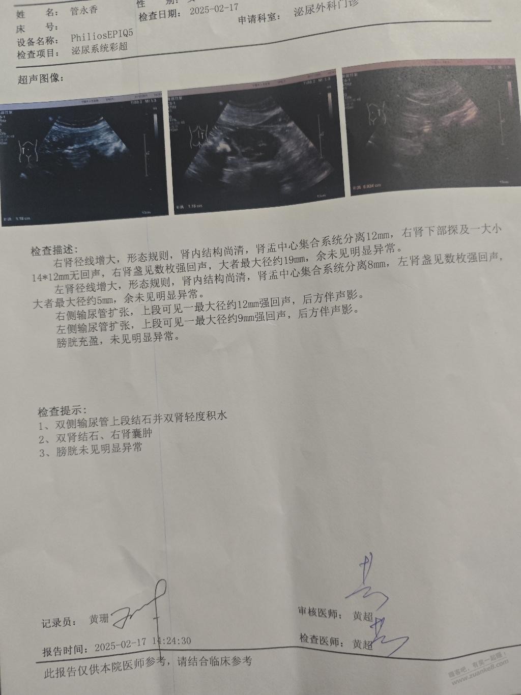 有懂结石的老哥吗，帮我看看我老妈比超需不需要做手术 - 线报迷